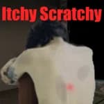 Itchy Scratchy